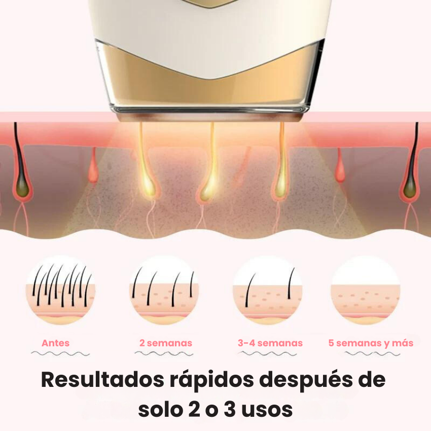 Depiladora Láser - Depilación Profesional en Casa con Tecnología Láser 🌸 Dropea